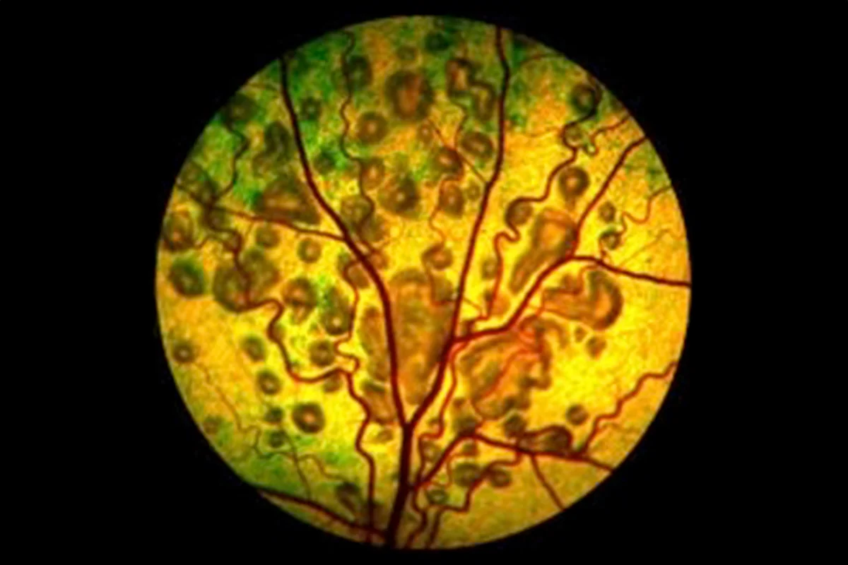 An ocular image showing a pet’s retina with signs of retinal dysplasia.