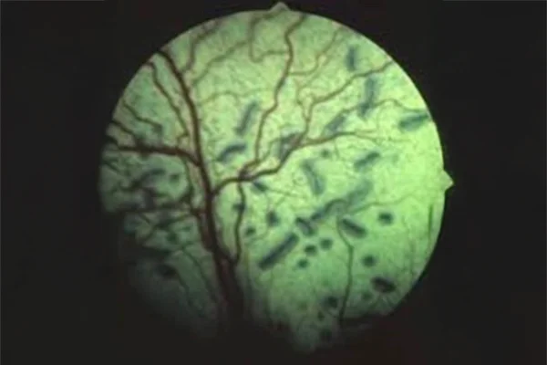 An ocular image showing a pet’s retina with abnormal development, indicating retinal dysplasia.